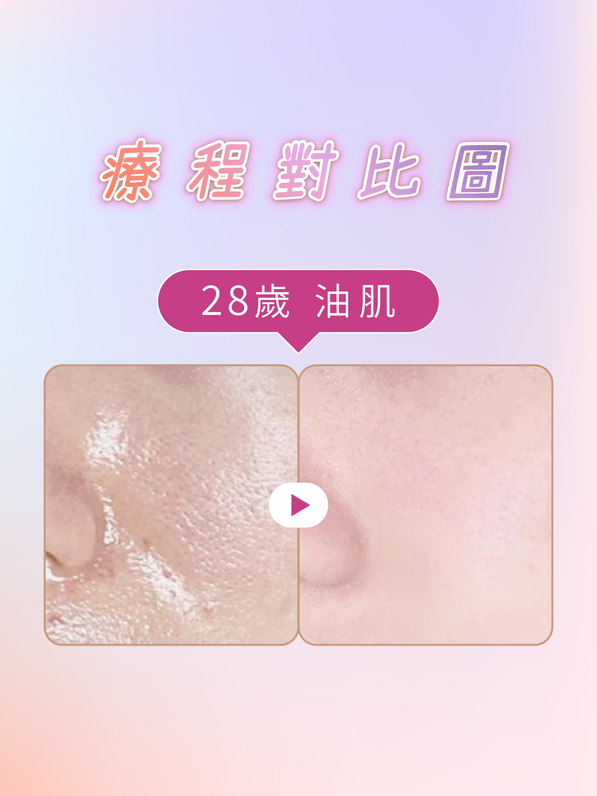 iff 啞光肌養成 對比參考 1